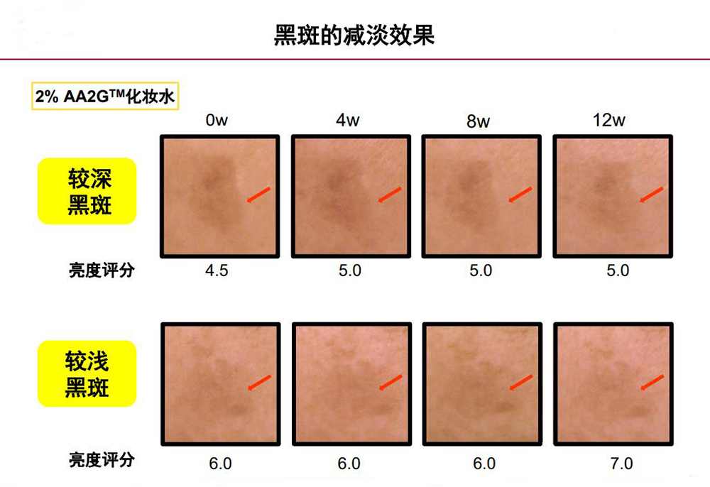 第一種材料：AA2G.jpg